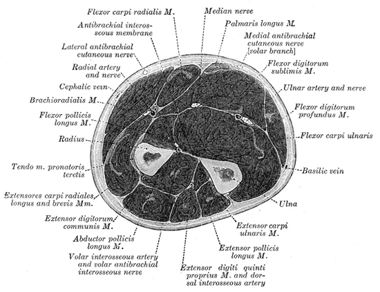 Anterior view of the left forearm showing the superficial flexor muscles — pronator teres, flexor carpi radialis, palmaris longus, and flexor carpi ulnaris — originating from the common flexor tendon at the medial epicondyle of the humerus, with muscle bellies labelled. Gray's Anatomy plate 417.